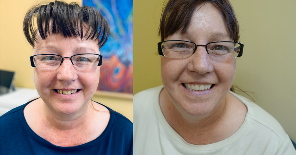 1st Class Dentures LLC Denture Care Center in Boise, ID