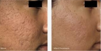 Before And After Before And After