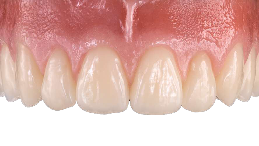1ST CLASS DENTURES 1ST CLASS DENTURES