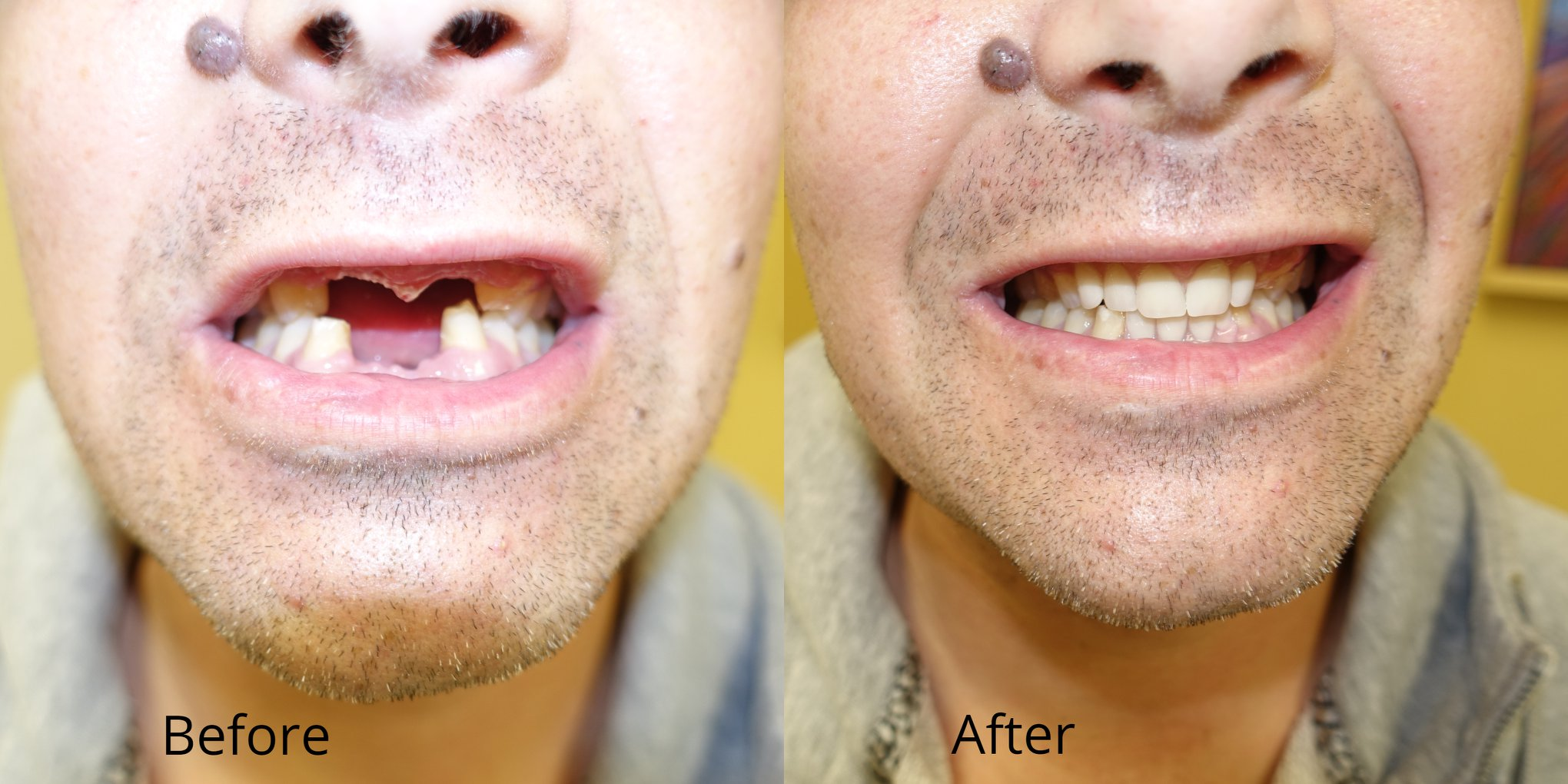 1st Class Dentures LLC Denture Care Center in Boise, ID